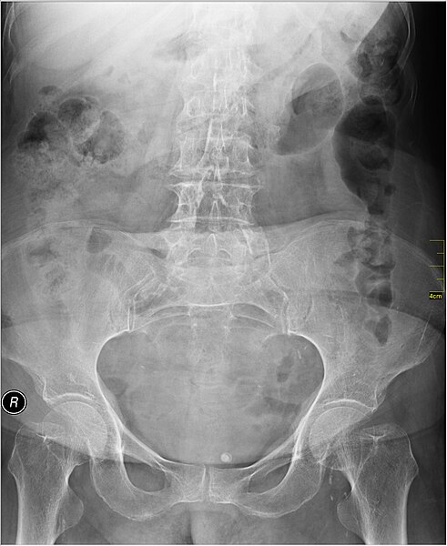 File:Medical X-Ray imaging PIO06 nevit.jpg