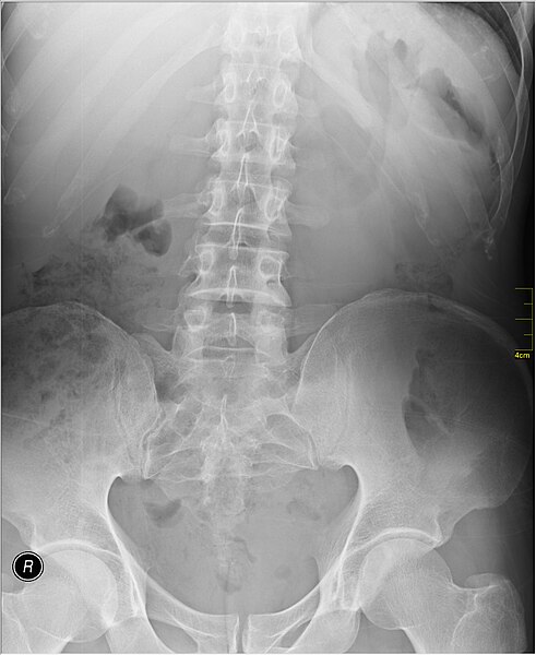 File:Medical X-Ray imaging RED06 nevit.jpg