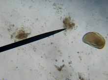 File:Opalina ranarum.webm