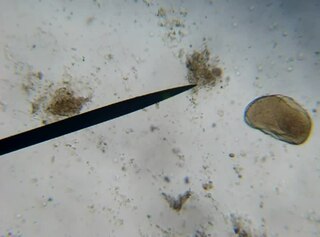 <i>Opalina</i> Genus of single-celled organisms