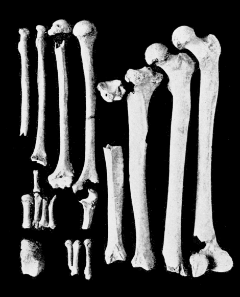 PSM V62 D474 Limb bones of the lansing skeleton.png