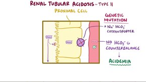 ملف:Renal tubular acidosis.webm