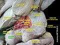 Stomach dissection highlighting pyloric canal.jpg