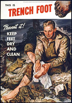 THIS IS TRENCH FOOT. PREVENT IT^ KEEP FEET DRY AND CLEAN - NARA - 515785.jpg