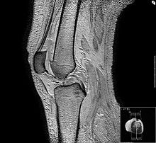 تصویربرداری رزونانس مغناطیسی MRI, سنجشگر SanjeshGar