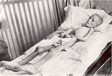 Lizzie van Zyl, a Boer child, visited by Emily Hobhouse in a British concentration camp LizzieVanZyl.jpg