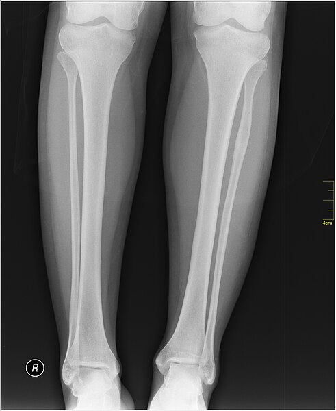 File:Medical X-Ray imaging WFU07 nevit.jpg