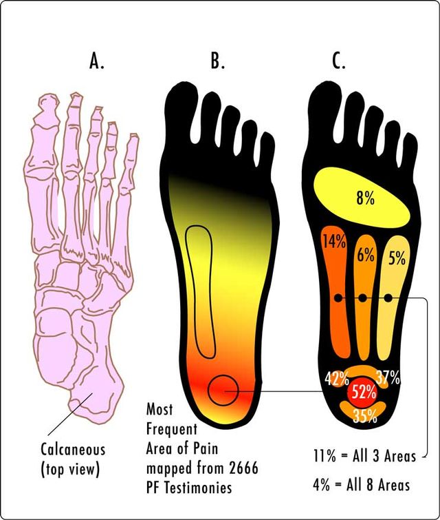 foot pain diagnosis diagram