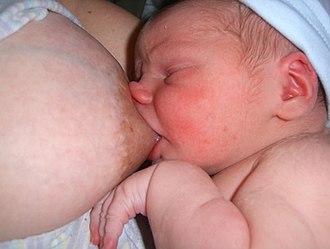 A shallow latch, where the tongue does not have good contact with the areola, leads to pain and poor milk flow. Poor breastfeeding latch.jpg