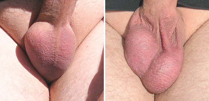 File:Scrotum.jpg.