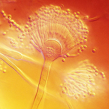 File:Aspergillus terreus.jpg