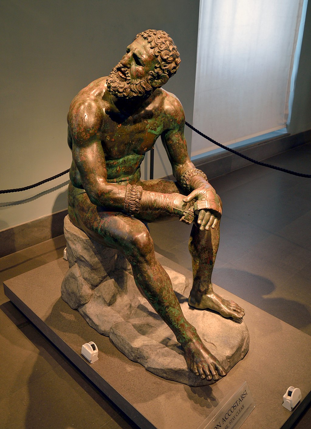 Boxer at Rest, c. 330-50 BCE, Palazzo Massimo alle Terme, Rome, Italy. source: Wikimedia Commons