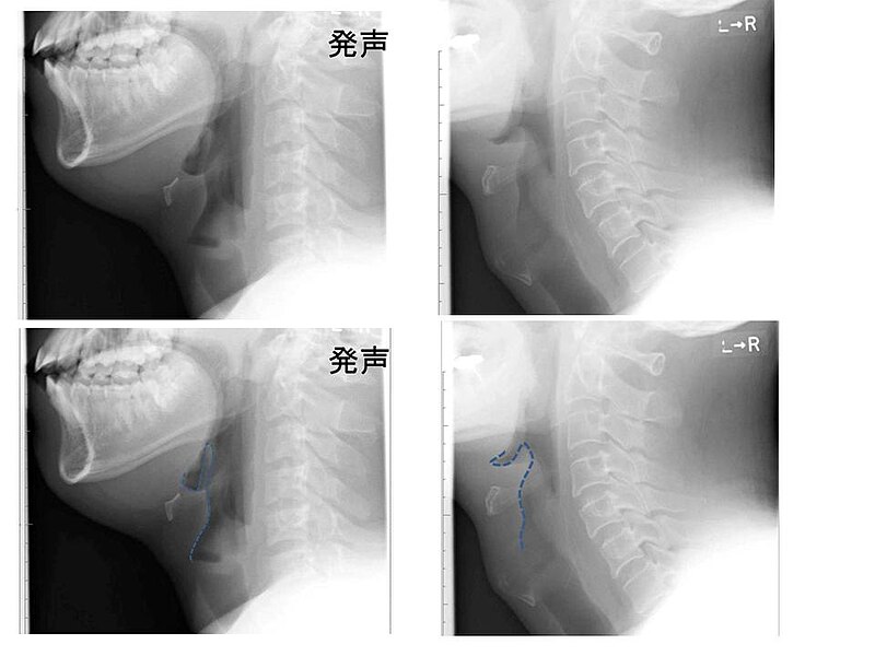 File:Compare epiglottis.jpg