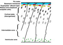 Corticogenesis in a reeler mutant mouse. Note the so-called "inverted cortex", disorganized cellular layers, oblique angles of radial glia fibers. Corticogenesis in reeler mutant mouse with captions in english.png