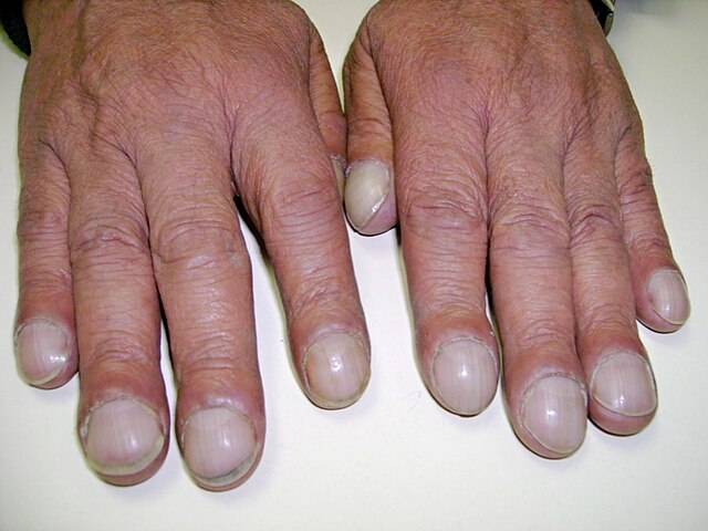 What You Need to Know About COVID Nails