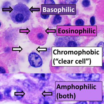 Chromophobe cell