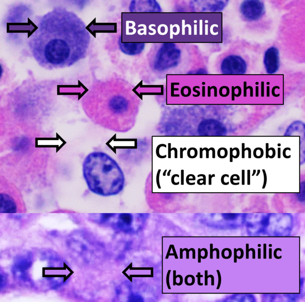File:Eosinophilic, basophilic, chromophobic and amphophilic staining.png