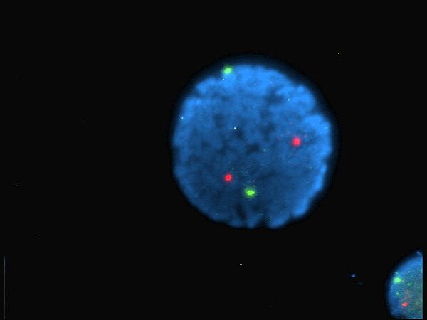 A fluorophore-labeled human cell.