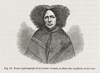 Figure 19: "From a photograph of an insane woman, to show the condition of her hair". Insane woman from Darwin's Expression of the Emotions. Wellcome L0049513.jpg