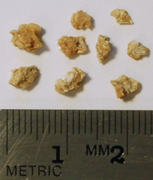 Some of the passed fragments of a 1-cm calcium oxalate stone that was smashed using lithotripsy Kidney stone fragments.png