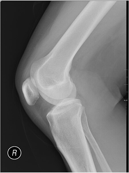 File:Medical X-Ray imaging BYW03 nevit.jpg