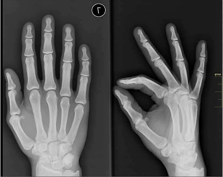 File:Medical X-Ray imaging VZX07 nevit.jpg