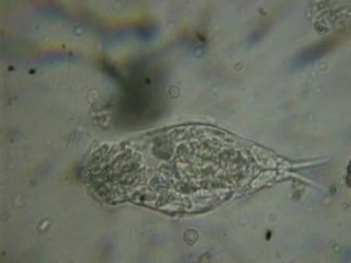 <i>Cephalodella</i>