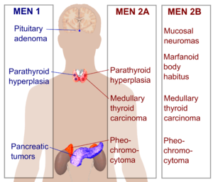 Useita endokriinisiä neoplasioita. Png