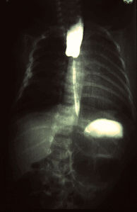 Radiology 0001 Nevit.jpg