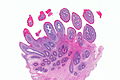 Photomicrographie d'un papillome malpighien sur une langue. Coloration à l'hématoxyline et à l'éosine.