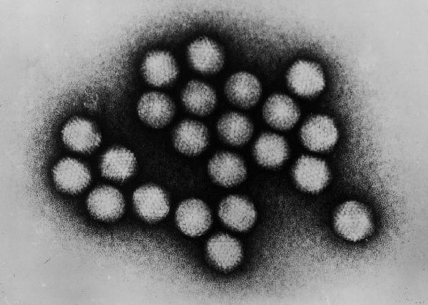 Adenoviruses as seen under an electron microscope