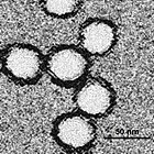 Electron micrograph of West Nile virus
