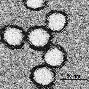 English: Electron microscopy of West Nile viru...