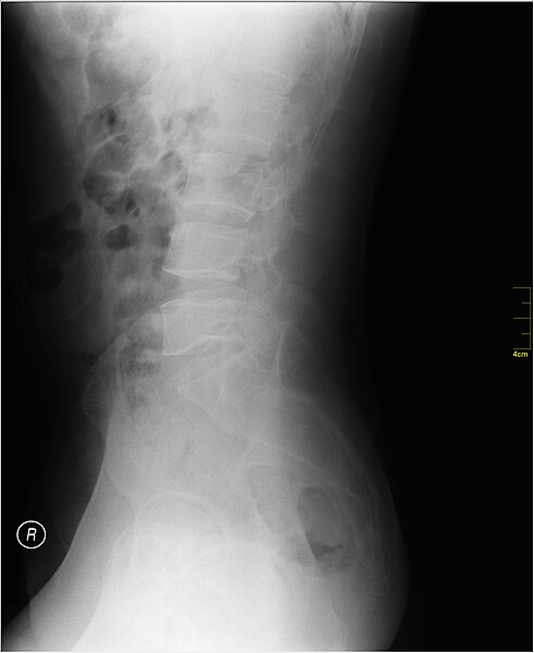 File:Medical X-Ray imaging QYY06 nevit.jpg