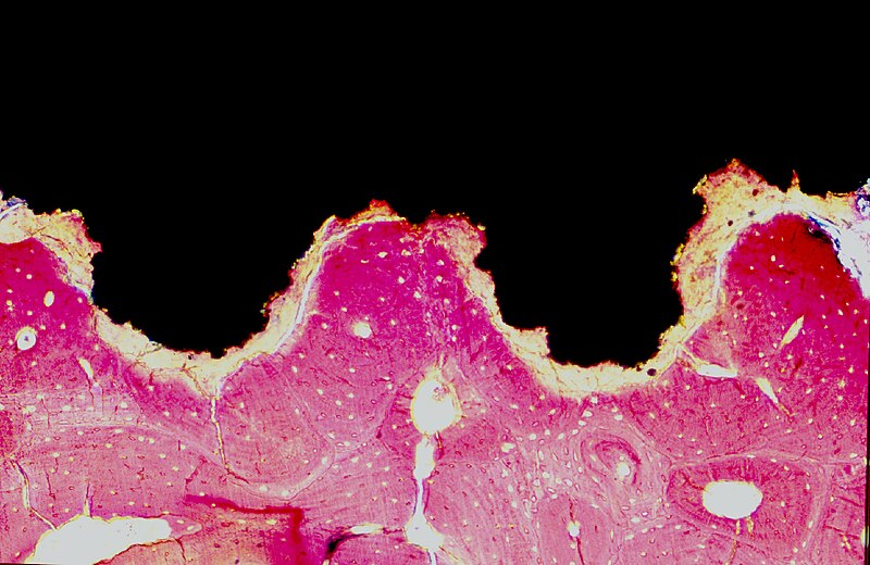 File:Osseointegration Histology.jpg