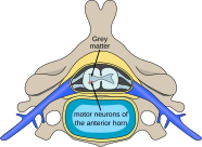 Polio spinal diagram-en.svg