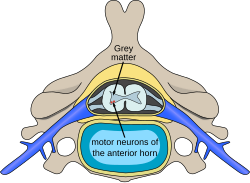 Polio spinal diagram-en.svg