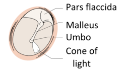 Voir-normal-tympanic-membrane.png