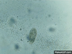 Paramecium feeding on bacteria