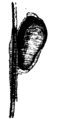 Ovum of the pediculus capitis or nit attached by a sheath to the hair 50x.