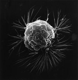 Когато нормалните клетки се увредят до степен да не могат да бъдат възстановени, тялото се освобождава от тях. Раковите клетки обаче продължават да се делят неконтролируемо.