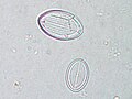 Cocconeis pediculus