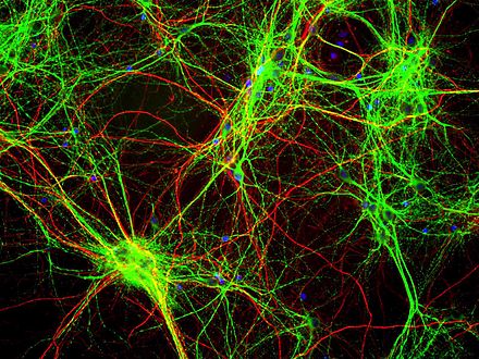 Brain neurons. Клетки головного мозга. Нейронная сеть. Мозговые Нейроны. Сеть нейронов.
