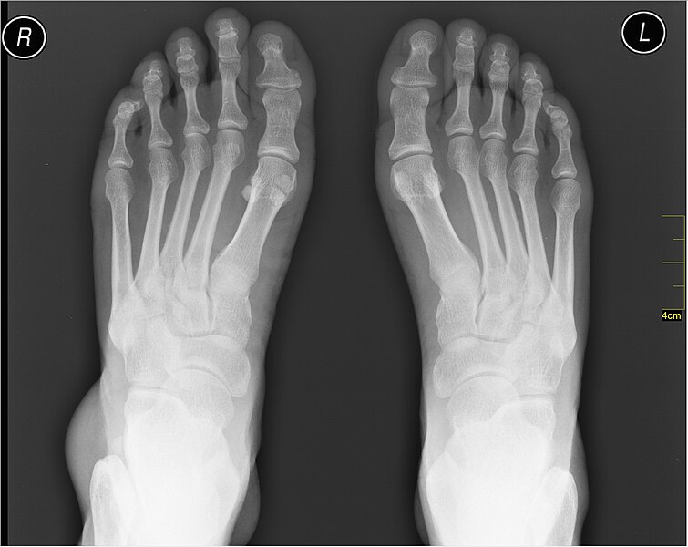 File:Medical X-Ray imaging RSO07 nevit.jpg