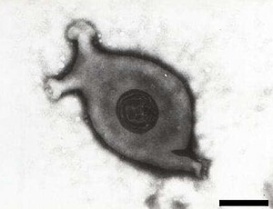 Mycoplasma gallisepticum