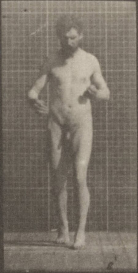 Fail:Nude man with lateral sclerosis walking (rbm-QP301M8-1887-548d~8).jpg