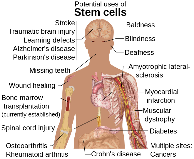 Diseases and conditions where stem cell treatment is being investigated.