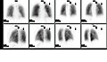 Prawidłowy obraz wentylacji i perfuzji płuc w różnych perspektywach (V/Q)