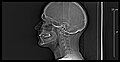 X-ray of the human skull (side view).jpg