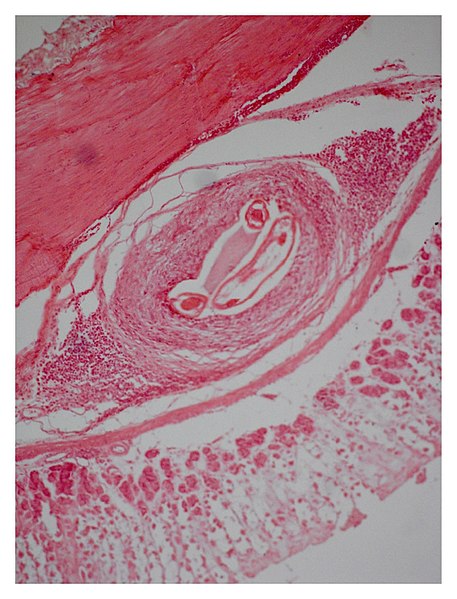 File:A-section-of-stomach-rabbit-showing-chronic-granuloma-around-S.jpg